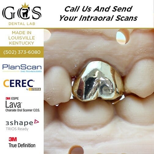 SEND US YOUR I.O.S FILES TODAY!  We are a TRIOS Ready Lab that is NOW accepting CEREC, 3M True Definition, 3M C.O.S, and Planscan or send you can send your STLs. Call us today! 502-373-6089
🦷
.
.
.
.
#GCSDentalLab #dentists #dentist #teeth #tooth #s