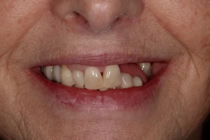 11-700x466.jpg