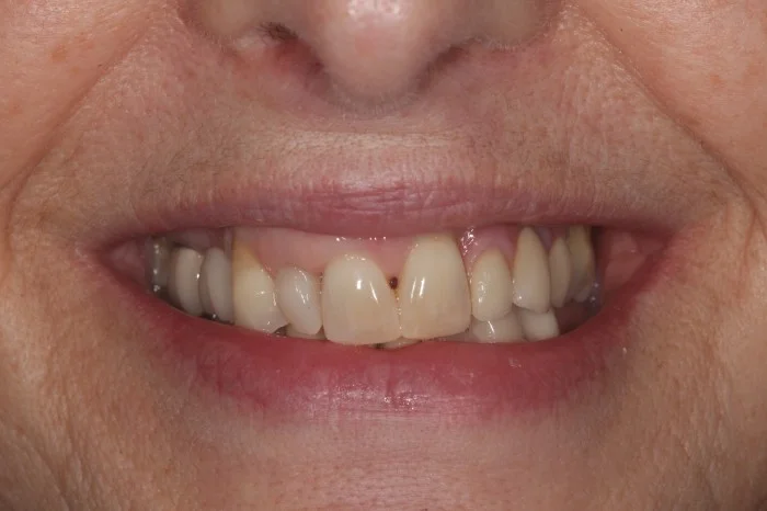 2-700x466.jpg