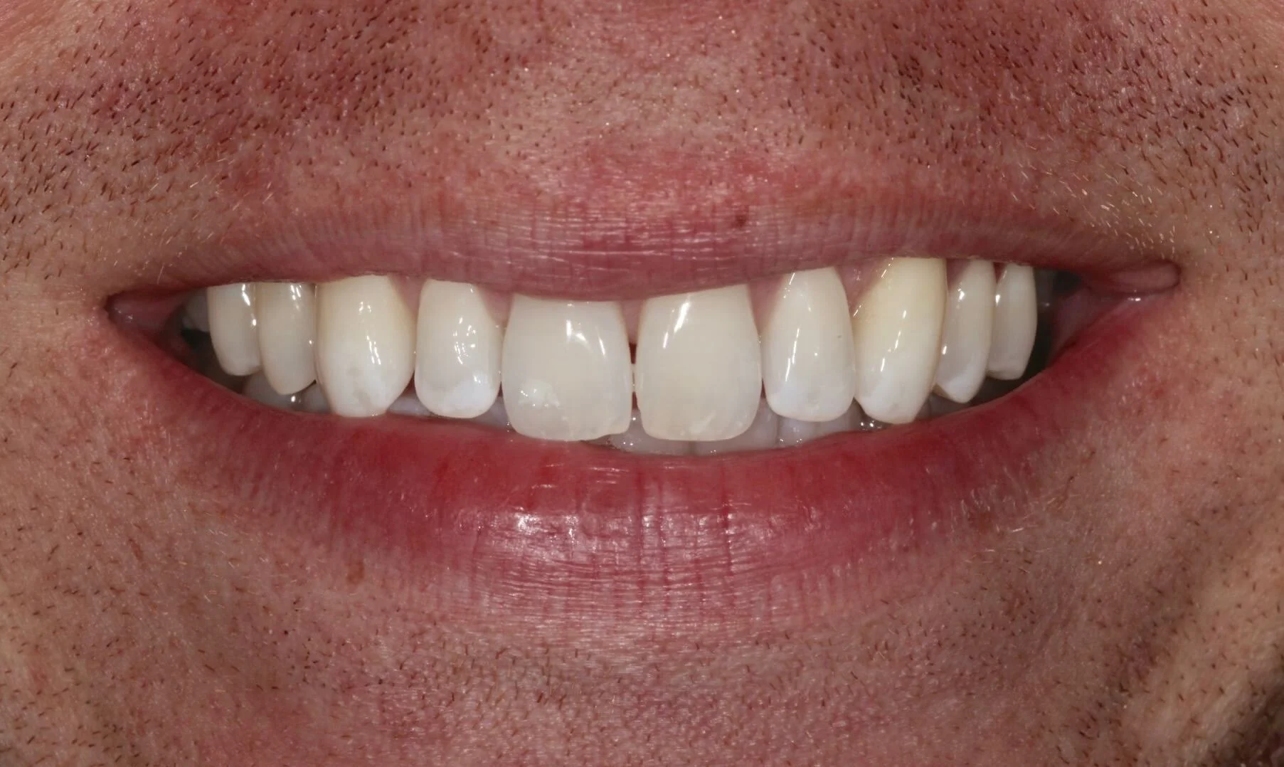 Lee Case 3 after.jpg