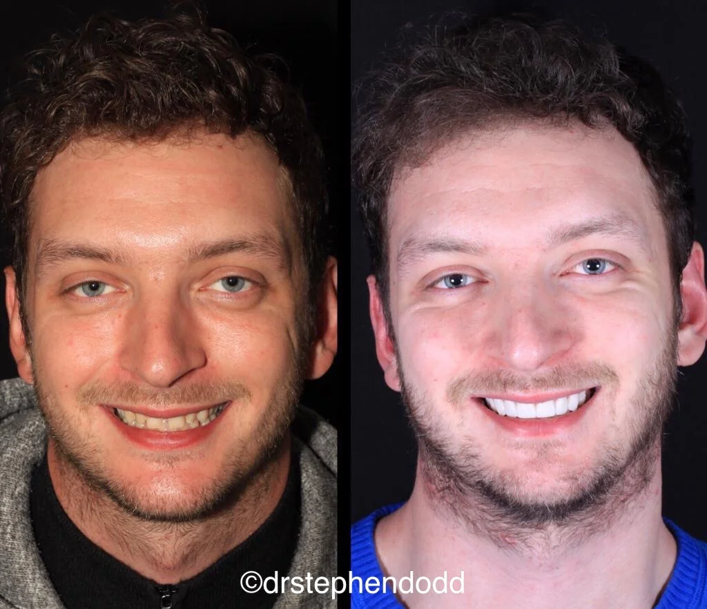 Full_face.jpeg
