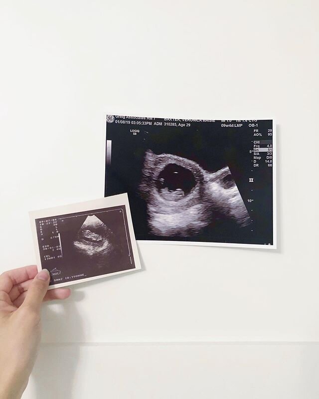 Our first &ldquo;#mommyandme&rdquo; photo 🙊 the left is my mother&rsquo;s ultrasound when she was pregnant with me! And the right is our little bean! ⁣
⁣
⁣
I can&rsquo;t believe she&rsquo;s almost here. This preggo is feelin&rsquo; large and in char