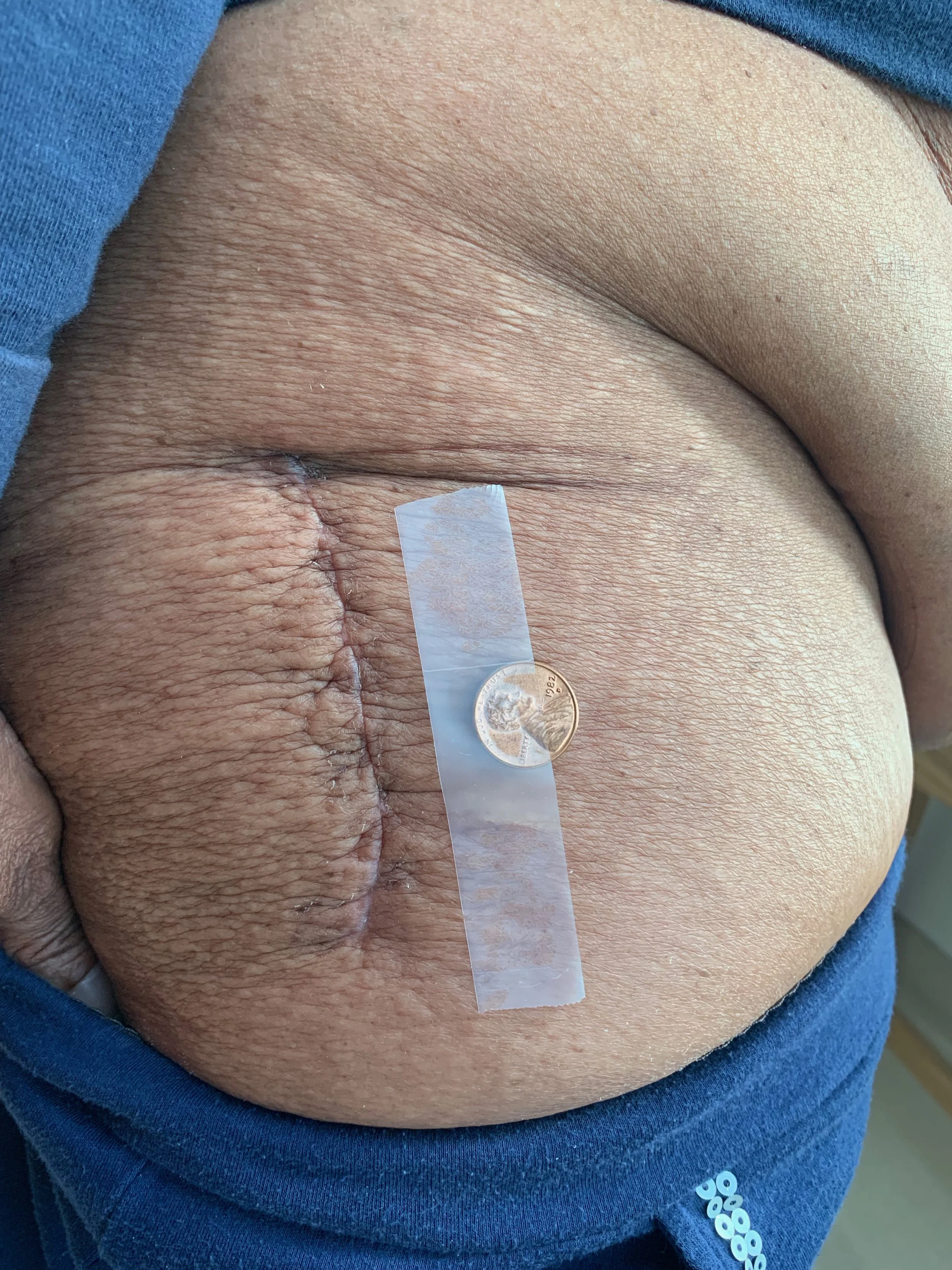    PATIENT STATS:   Height: 5 foot 7 inches                                        Weight: 207   