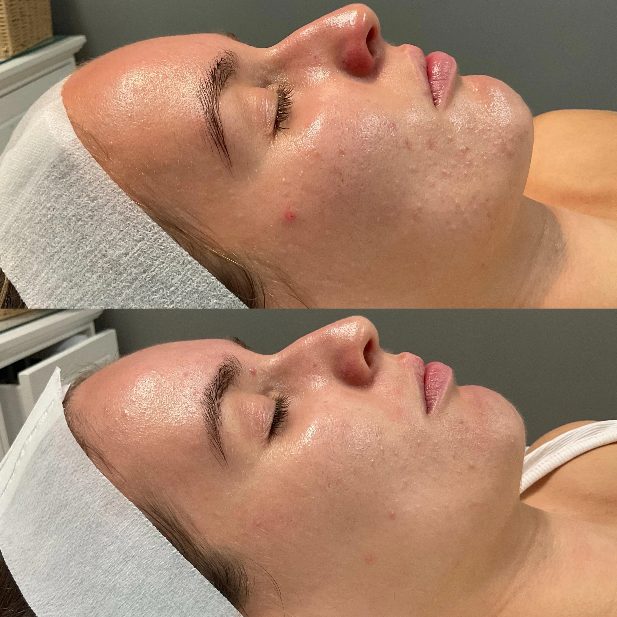 DMK Express Treatments