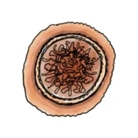 Roundworm.jpg