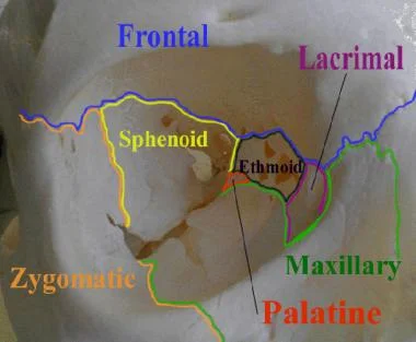 Right bony orbit. Image from Medscape , courtesy Google Images.