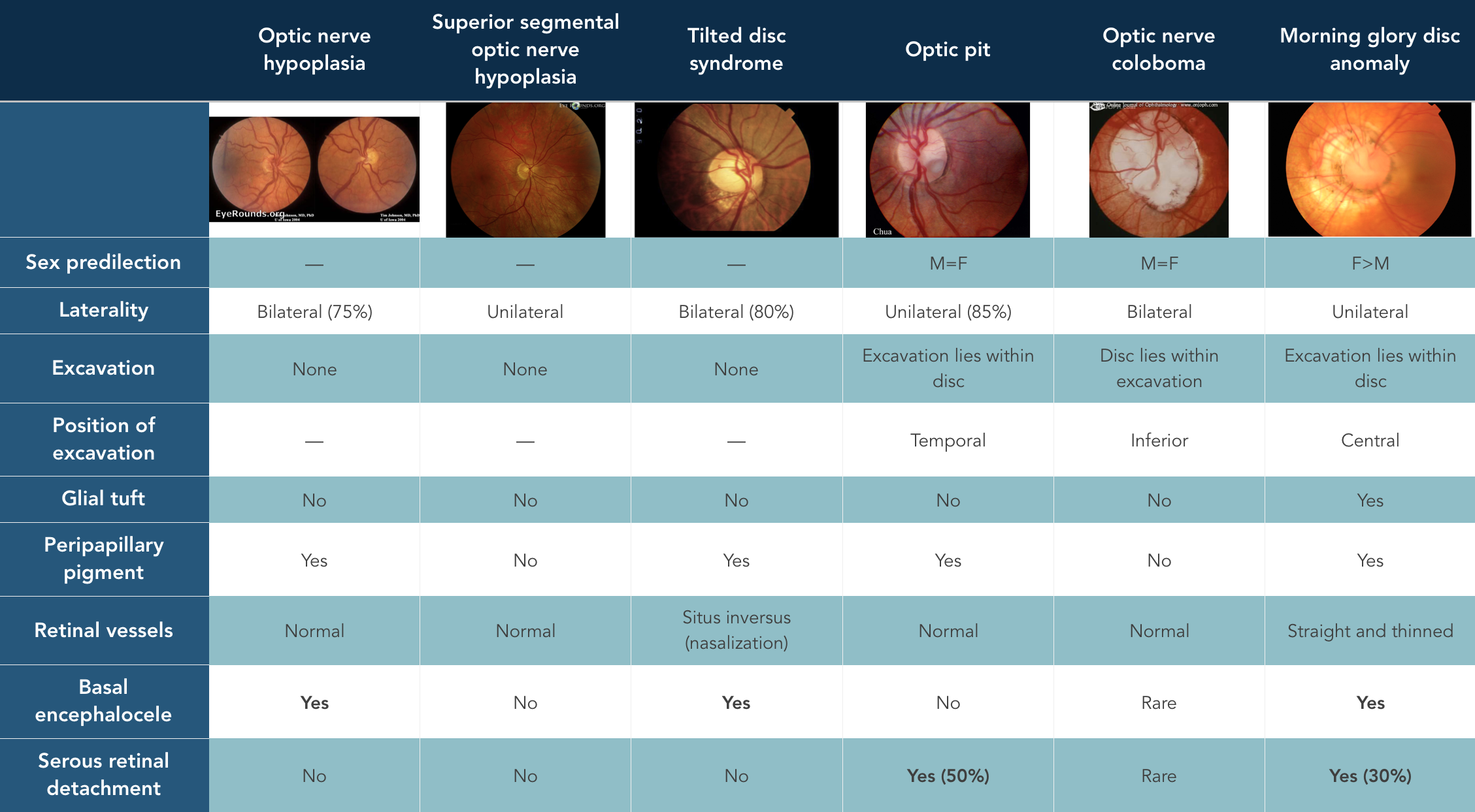 Congenital Optic Disc Anomalies — Ophthalmology Review (2023)
