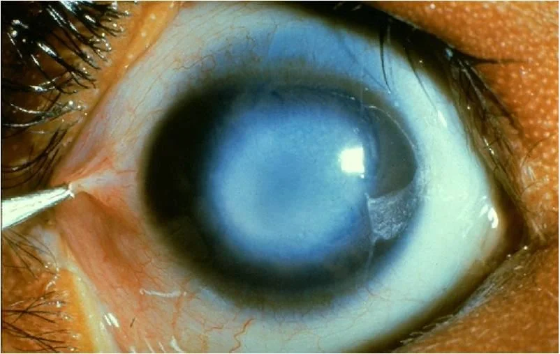 Image credit: studyblue.com .