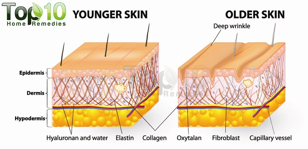 wrinkles-diagram-opt.jpg