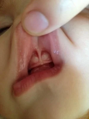 Jaclyn's+lip+tie+photo.jpg