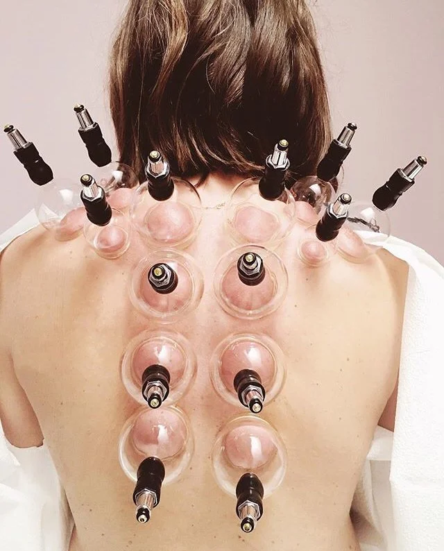 Accessible Ways to Incorporate Traditional Chinese Medicine At Home