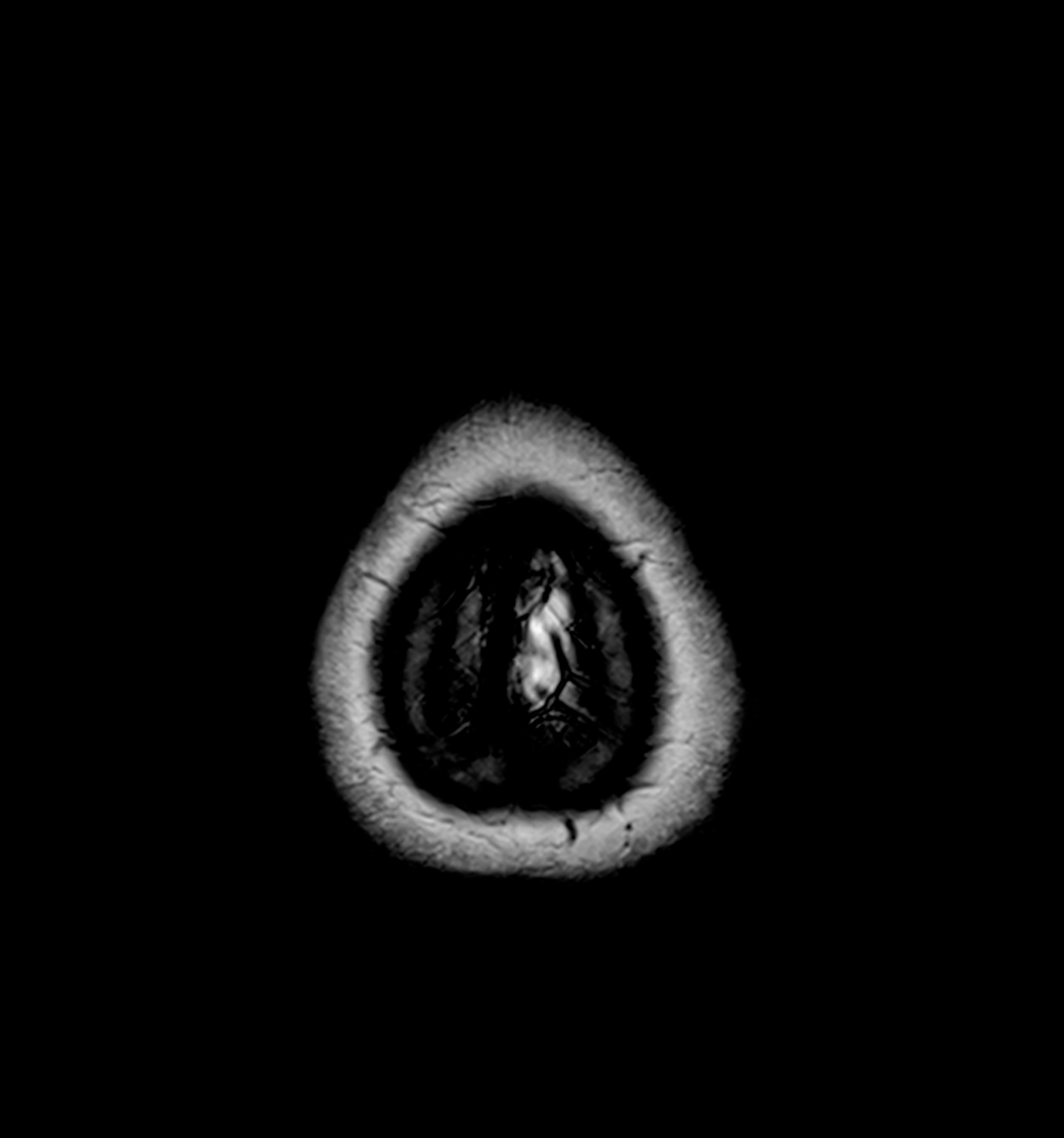 cabeza_0449_Layer 27.jpg