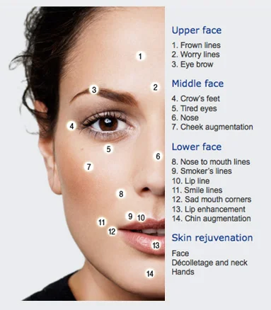 Dermal Fillers