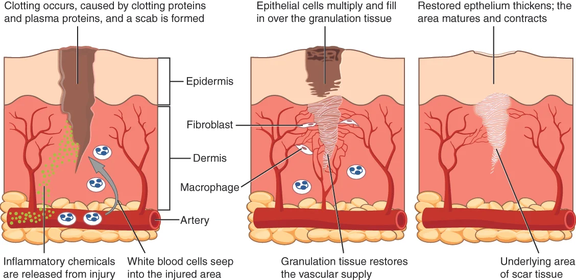 Process of scar formation: initial clotting of the wound, followed by closure of the wound by tissue growth, and eventual maturation of the scar