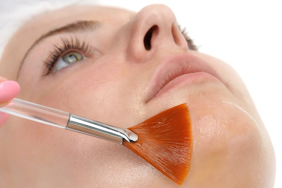 chempeel2.jpg
