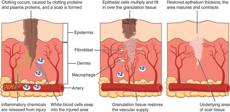 Process of scar formation: initial clotting of the wound, followed by closure of the wound by tissue growth, and eventual maturation of the scar