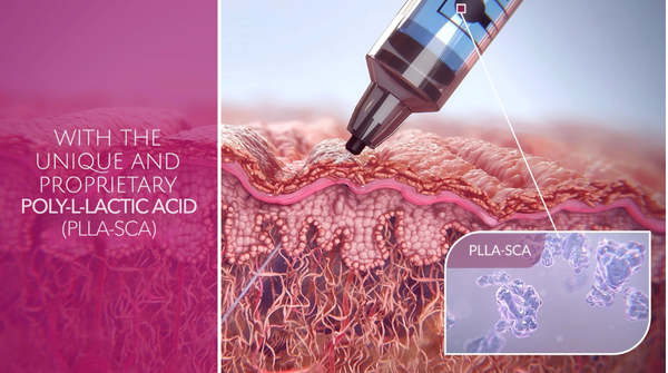 Graphic highlighting the proprietary formulation of Sculptra’s poly-L-lactic acid (PLLA) and its controlled biostimulatory effect for gradual, natural-looking rejuvenation
