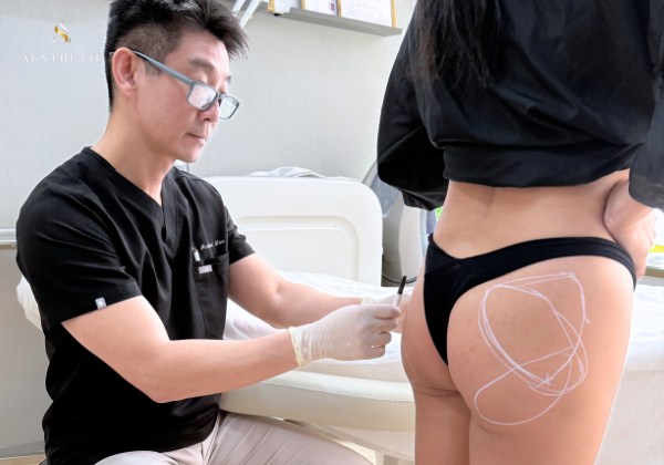 Injectable collagen stimulation for non-surgical butt lift to enhance buttock contour and firmness without surgery