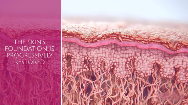 Illustration showing progressive collagen regneration and improved buttock firmness after Sculptra butt lift