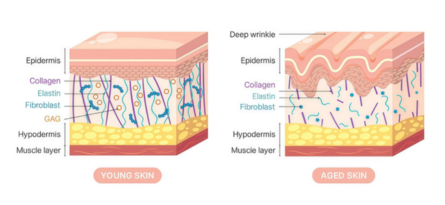 Diagram comparing the extracellular matrix in young and aged skin, showing collagen and elastin structure changes