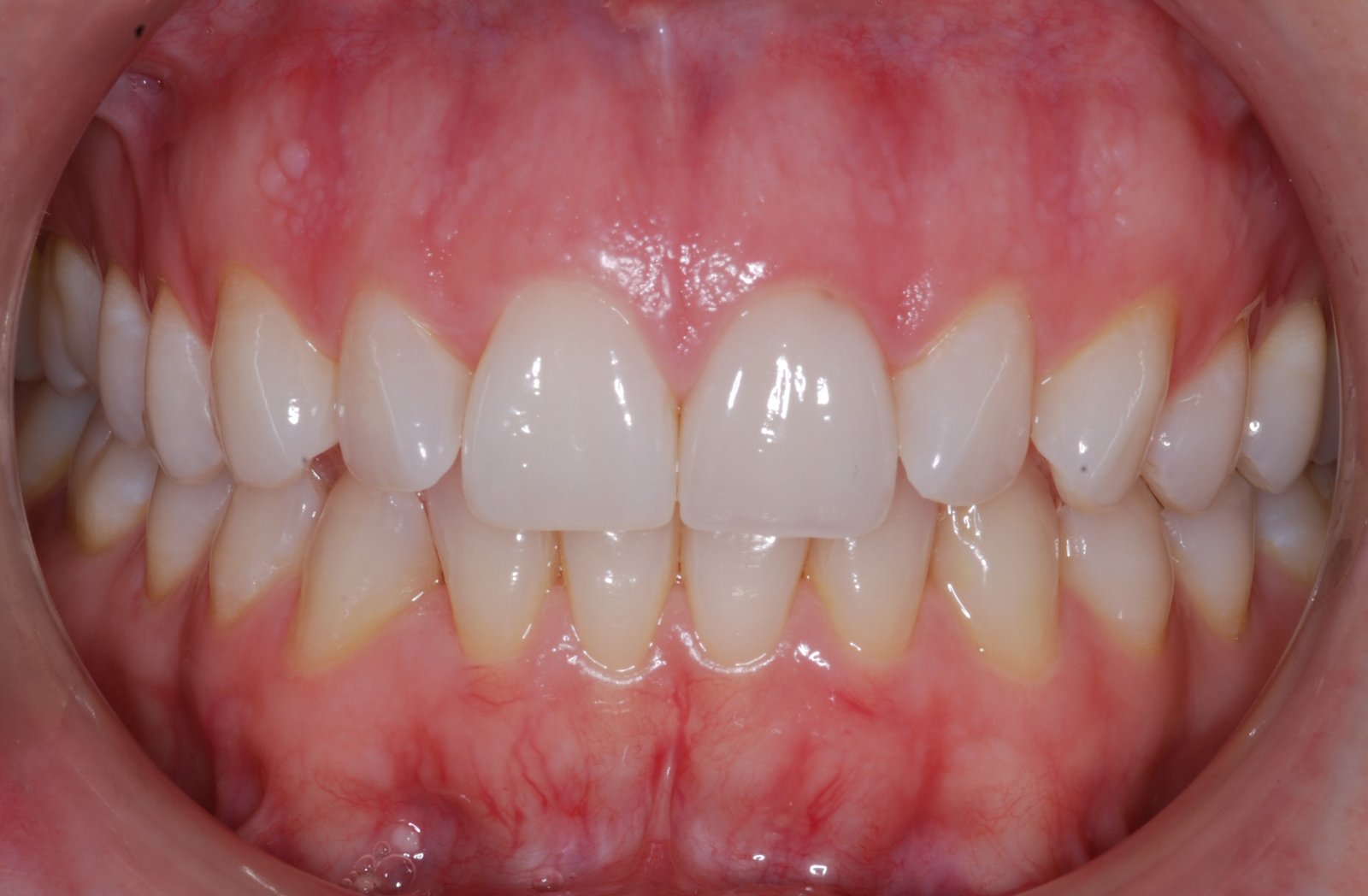 Healthy gums