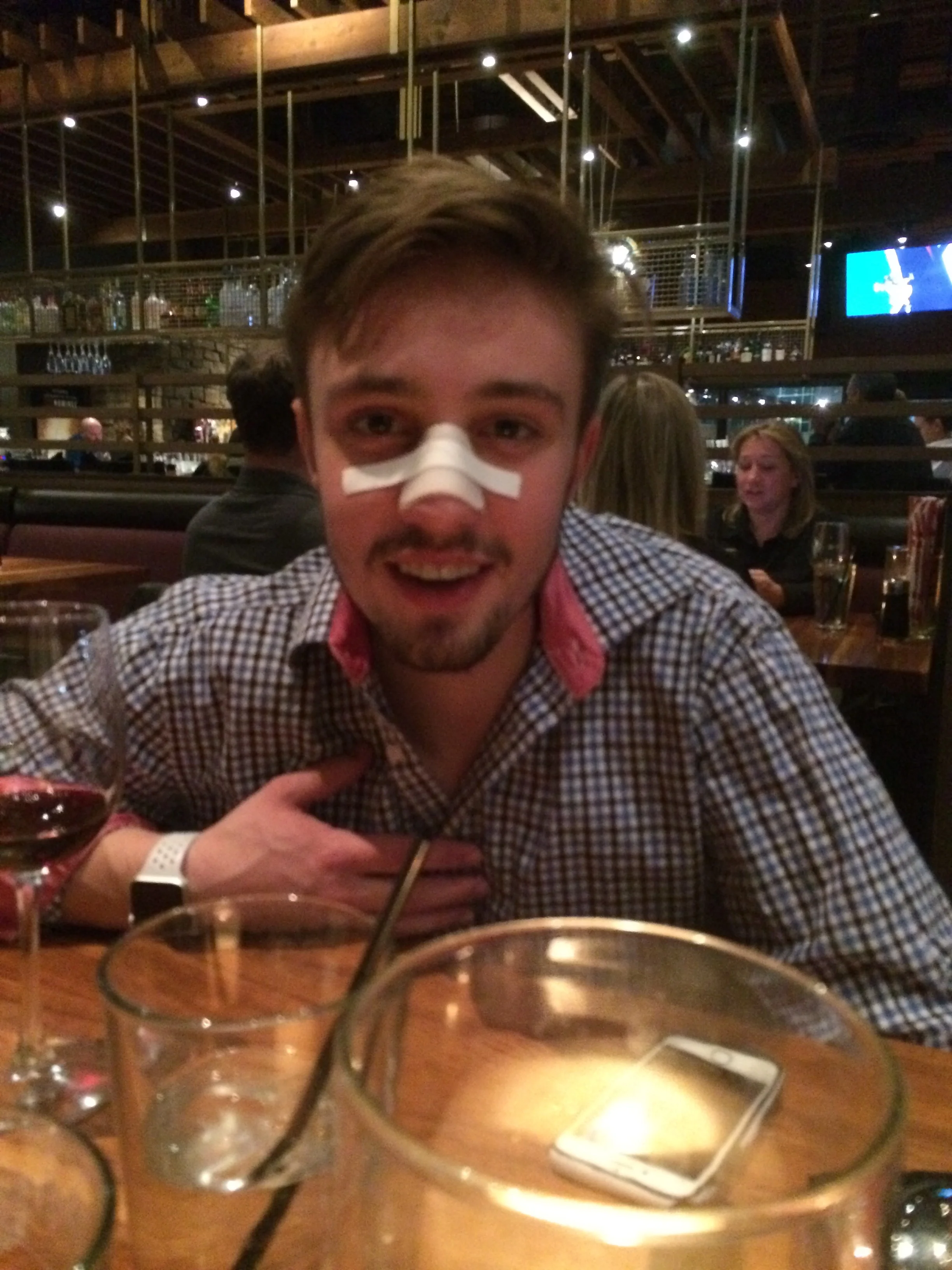 Austin broke his nose the day before his 21st BD.  He had surgery after and this is the result.