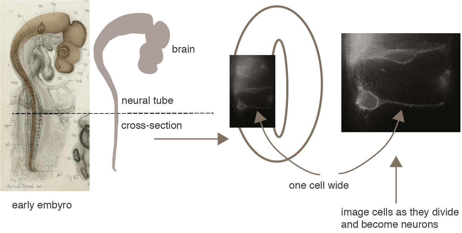 neuro1.png