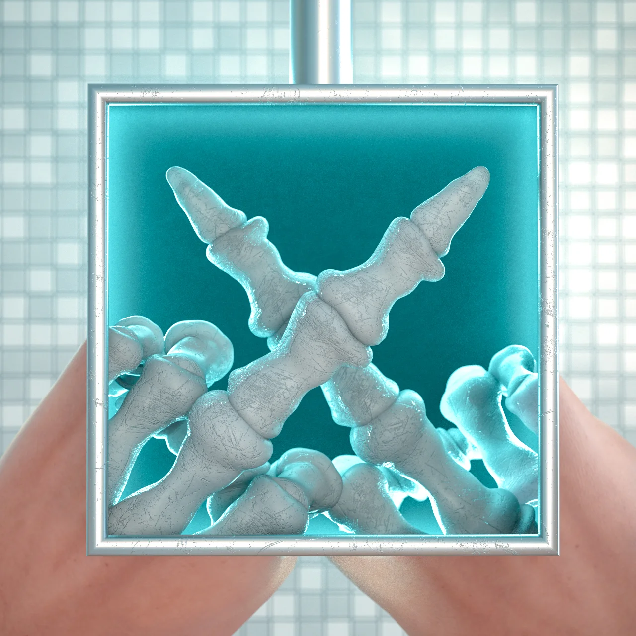 X for X-Rays!