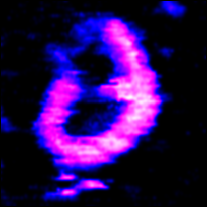 A DNA minicircle containing both single-stranded (blue) and double-stranded (pink) sections