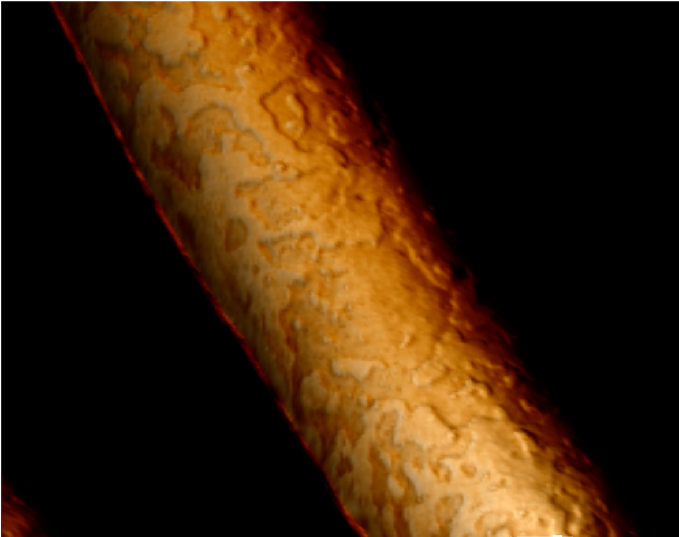 BacteriaTilamin.png