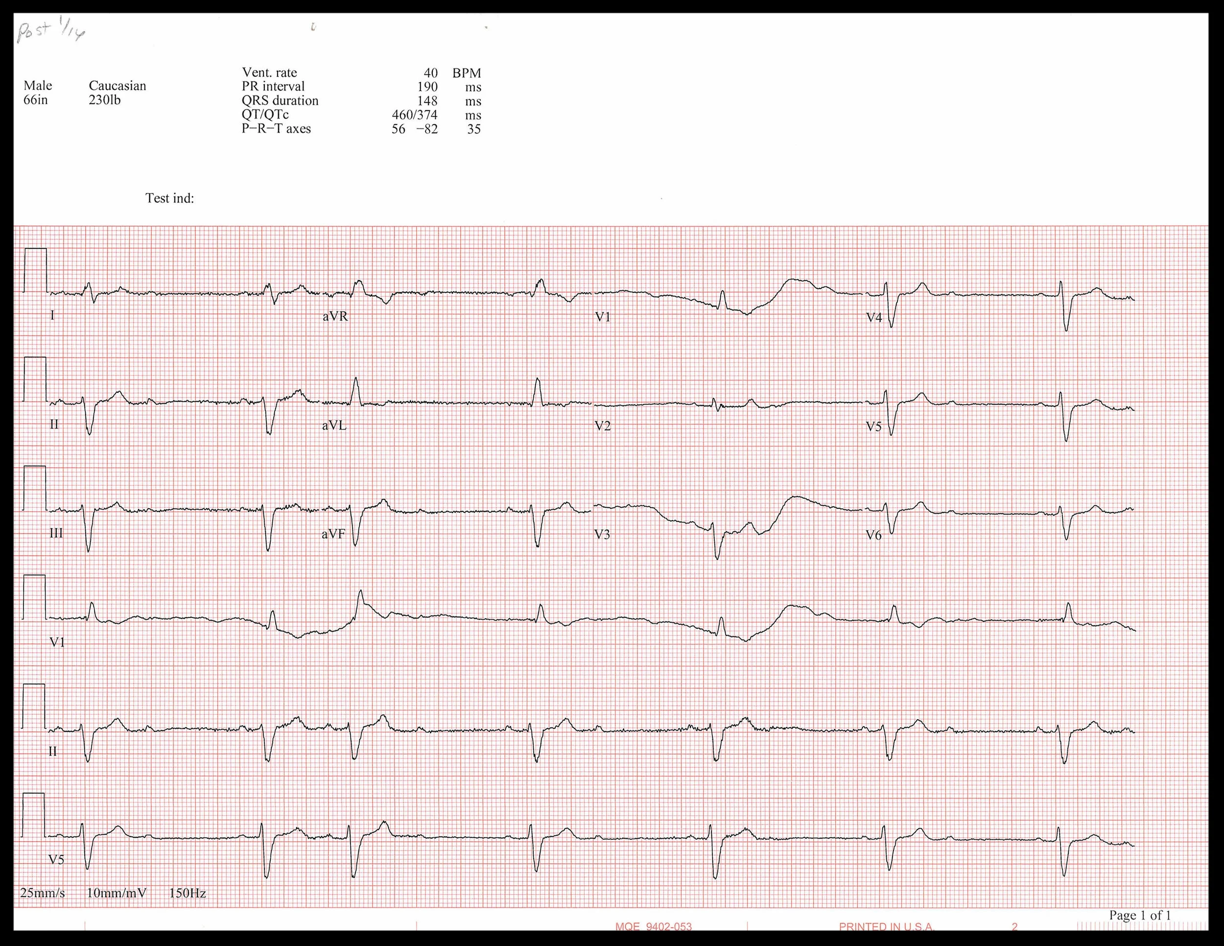 1-16 EKG_Page_1.jpg