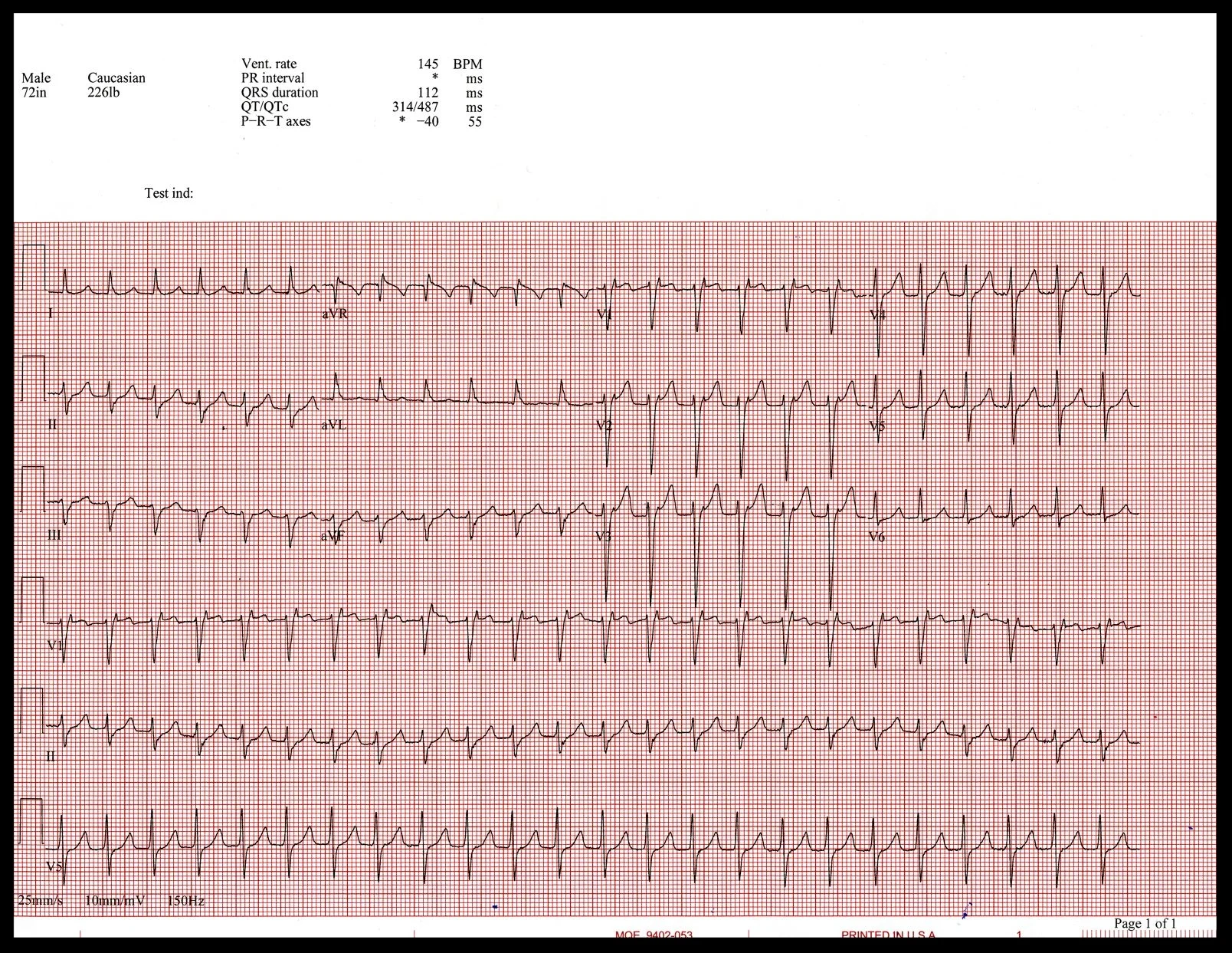 EKG scan001 (1).jpg