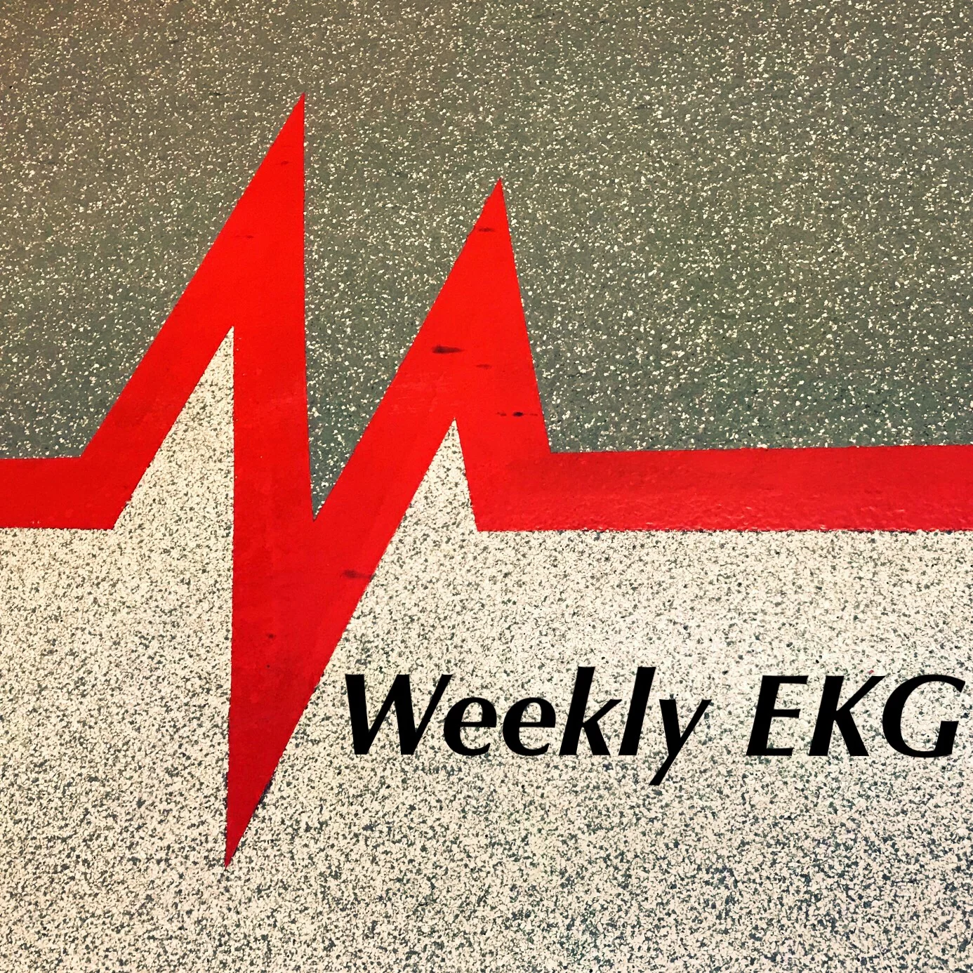 EKG of the Week