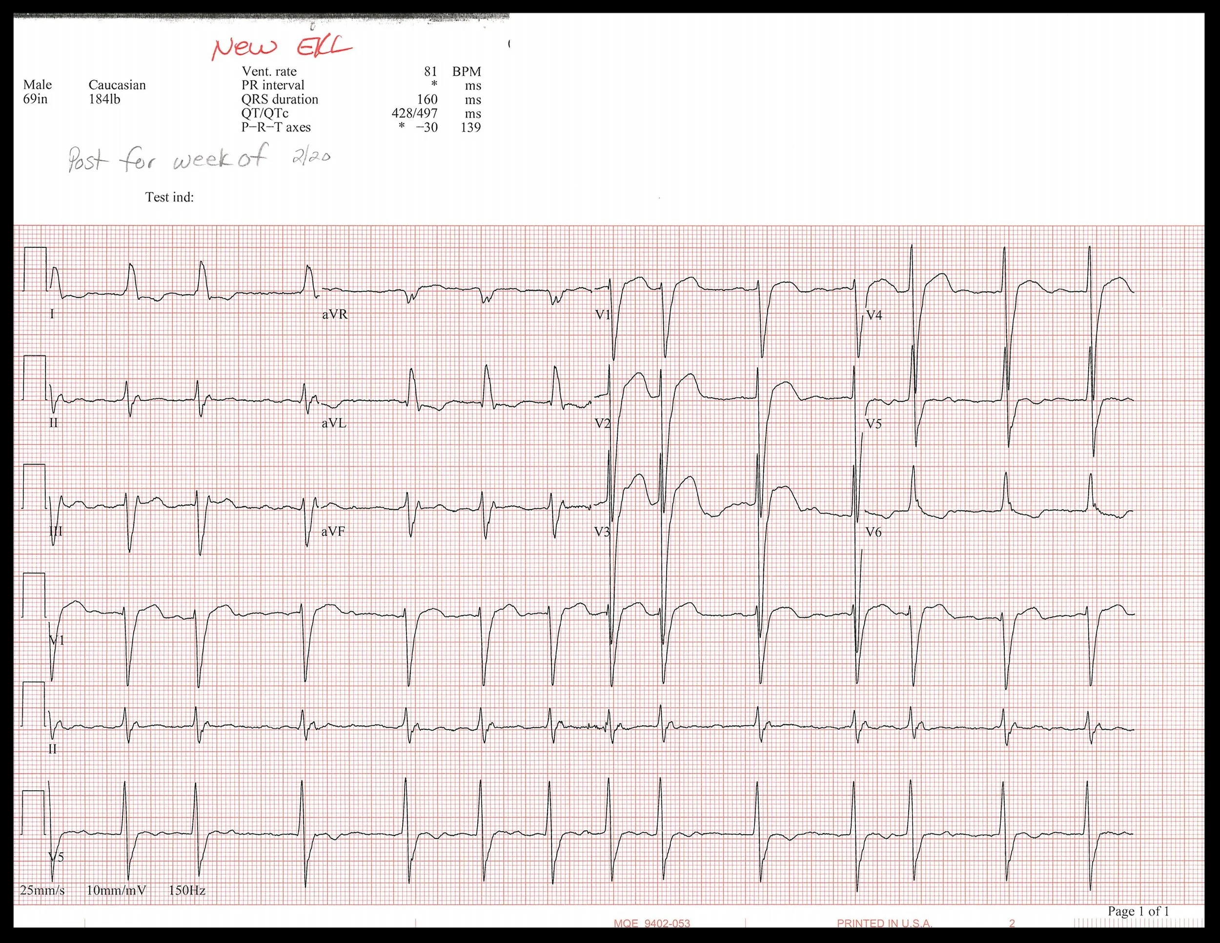 2-20 EKG_Page_1.jpg