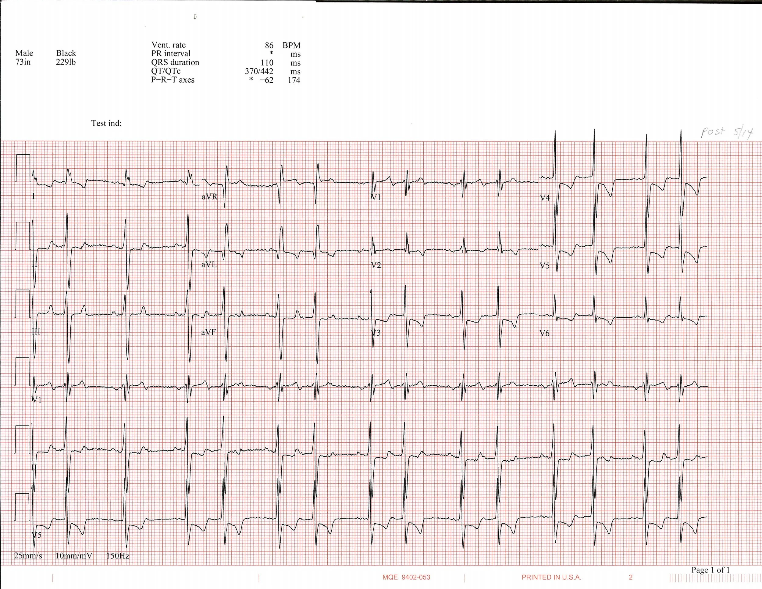 5-14 EKG_Page_1.jpg