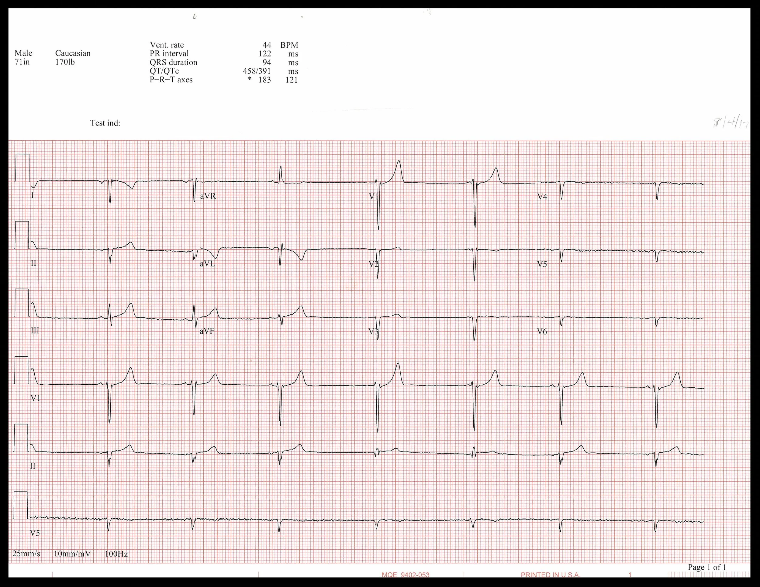 8-4 EKG_Page_1.jpg