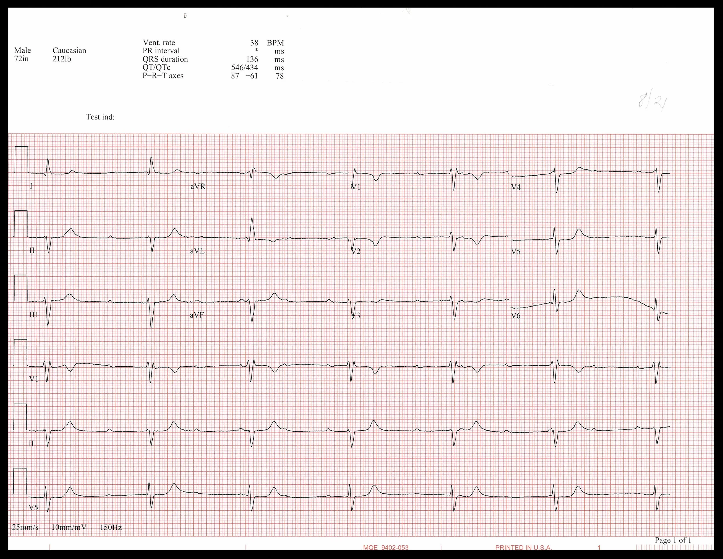 8-21 EKG_Page_1.jpg