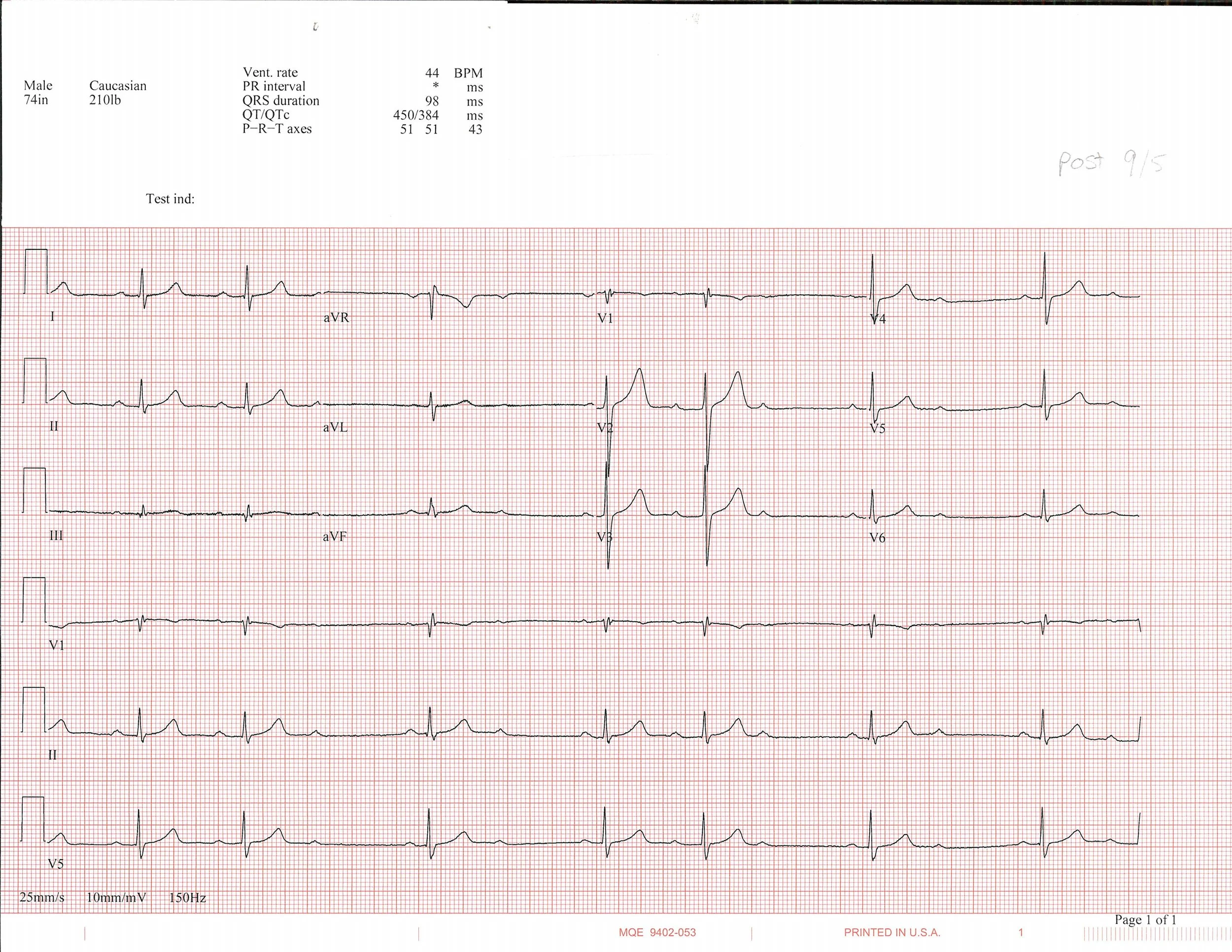 9-5 EKG_Page_1.jpg