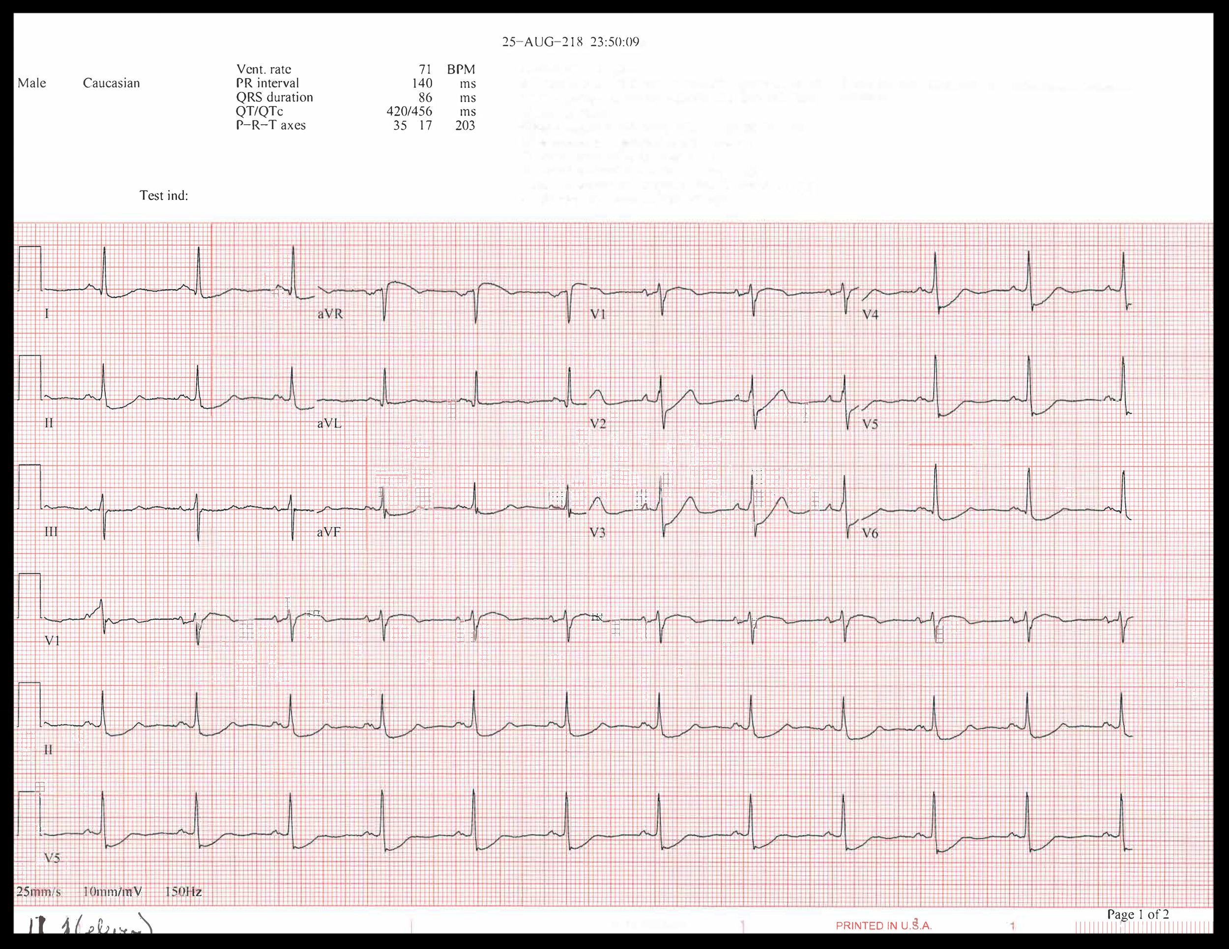 EKG of the week_Page_3.png