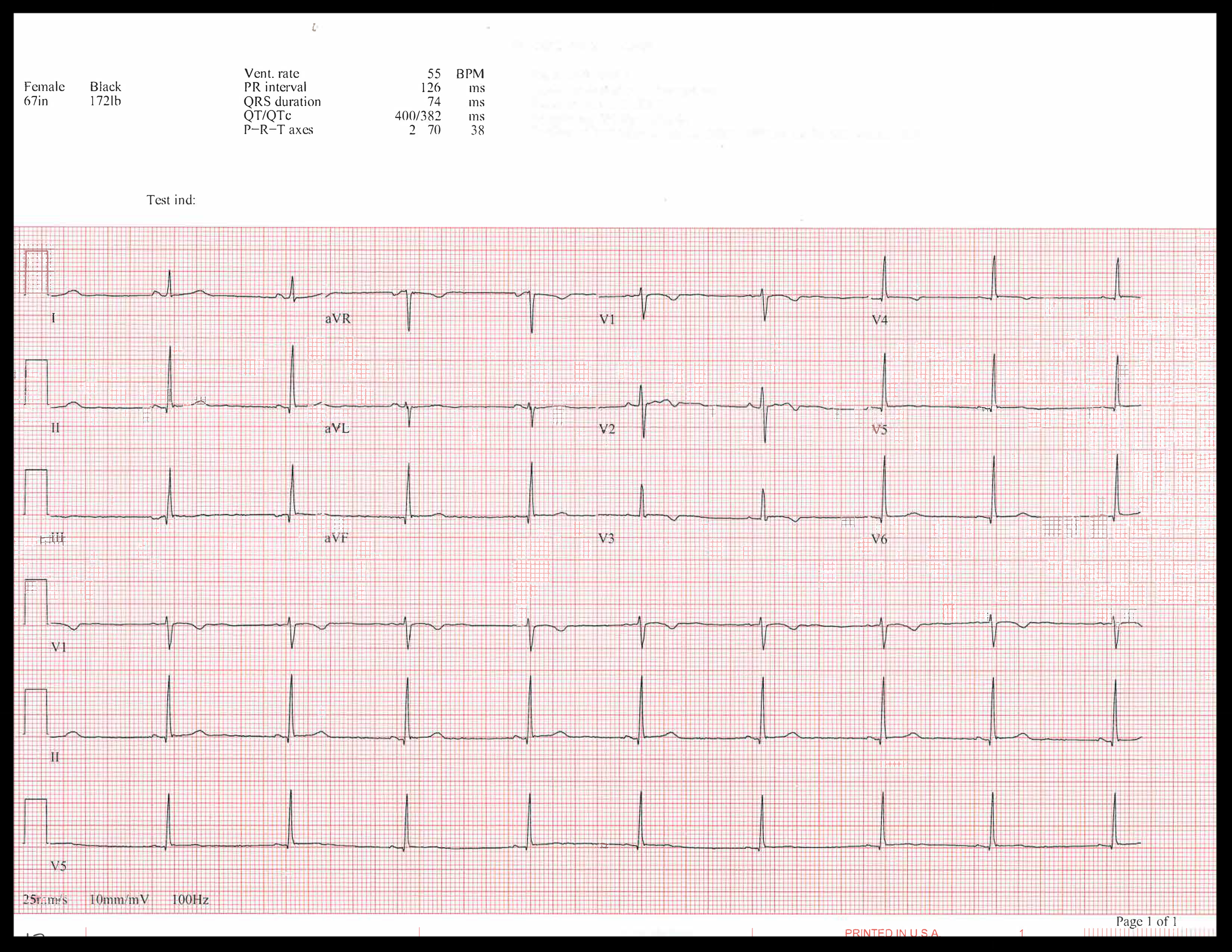 EKG of the week_Page_5.png
