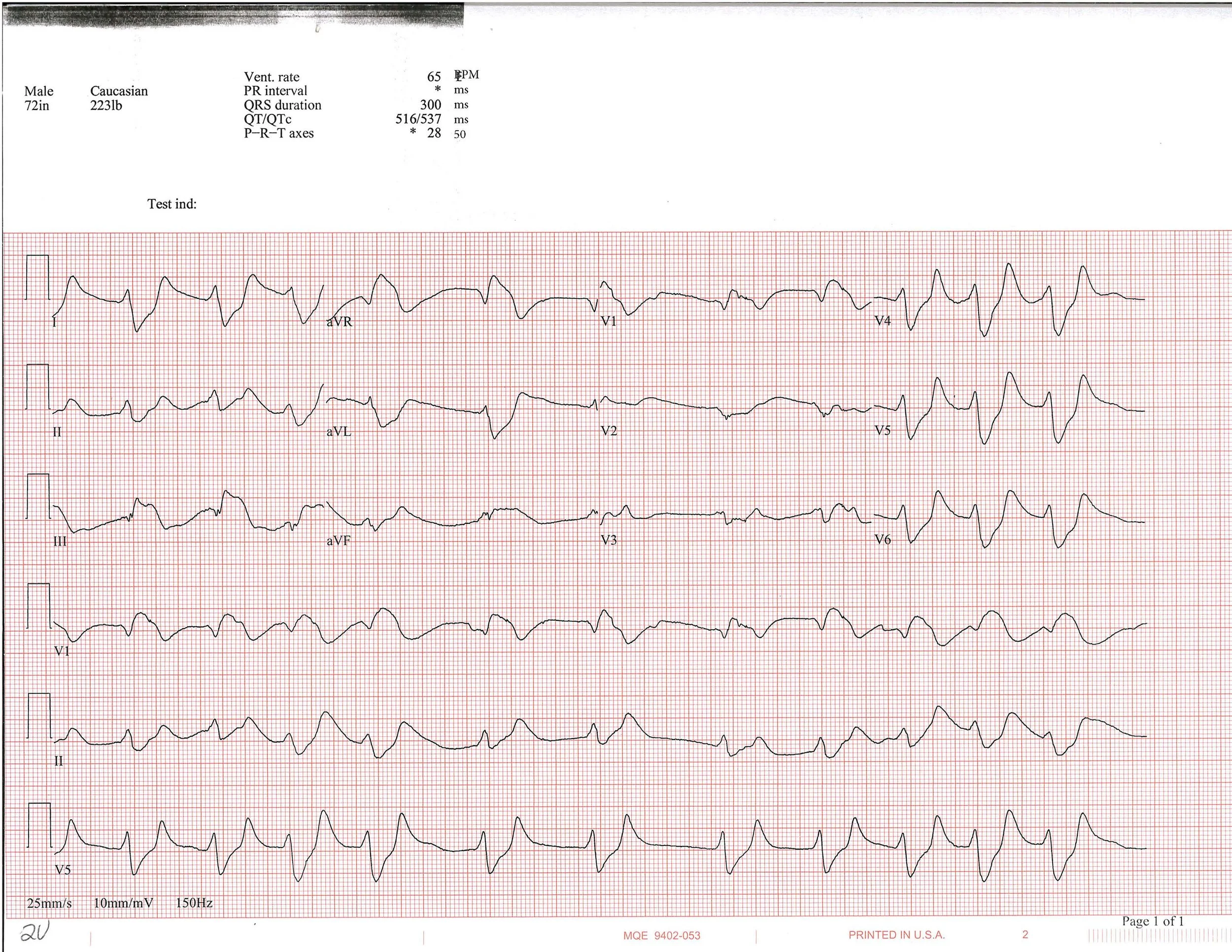 EKG of the week 4_Page_1.jpg