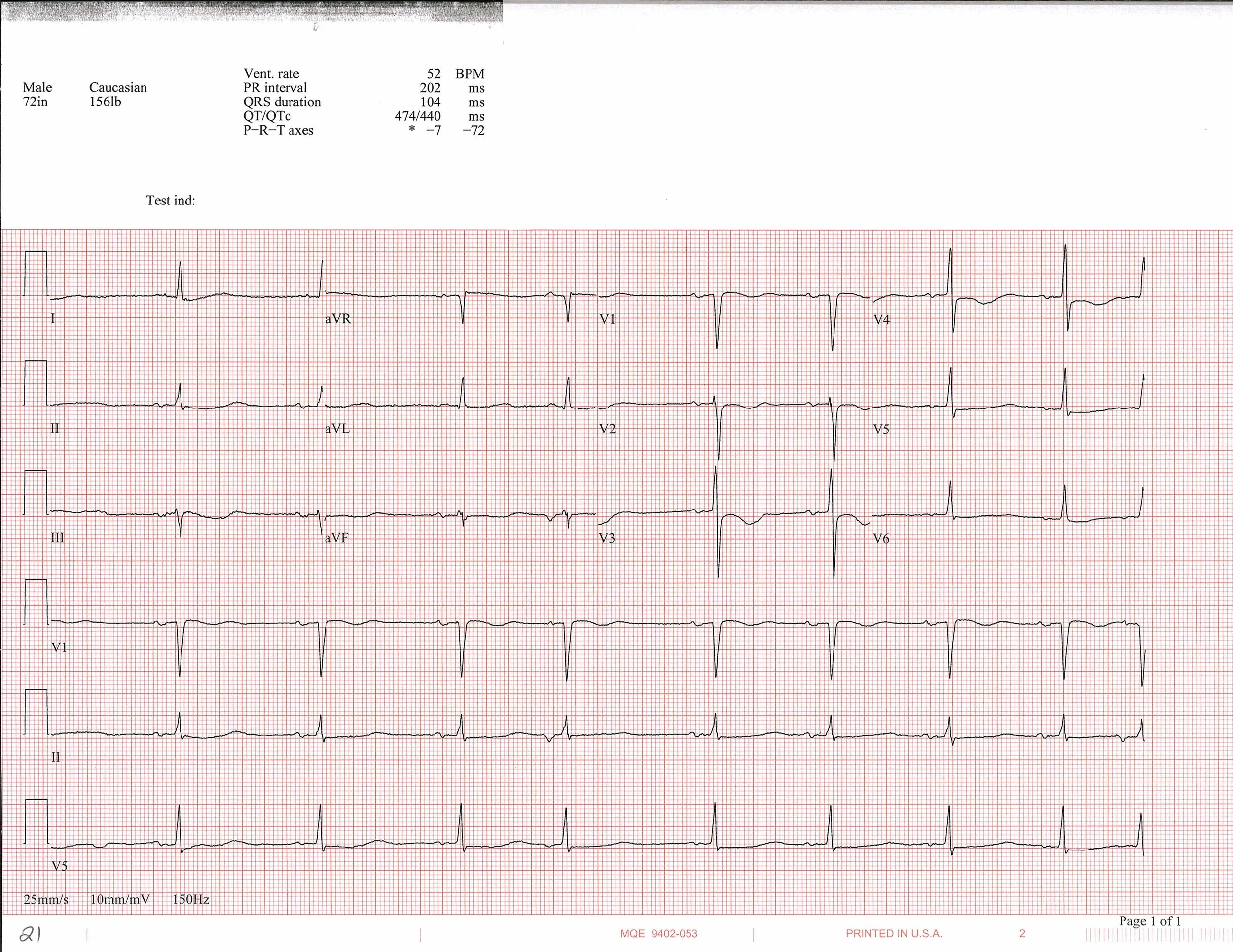EKG of the week 4_Page_2.jpg