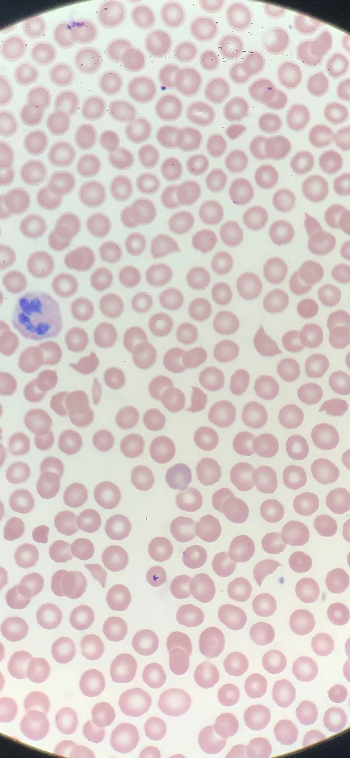 Academic Half Day: Heme/Onc Emergencies 2023