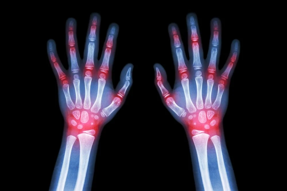 Academic Half Day: Rheumatologic Emergencies 2024