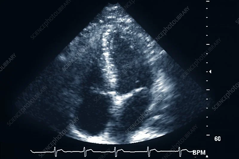 Academic Half Day: POCUS 2023