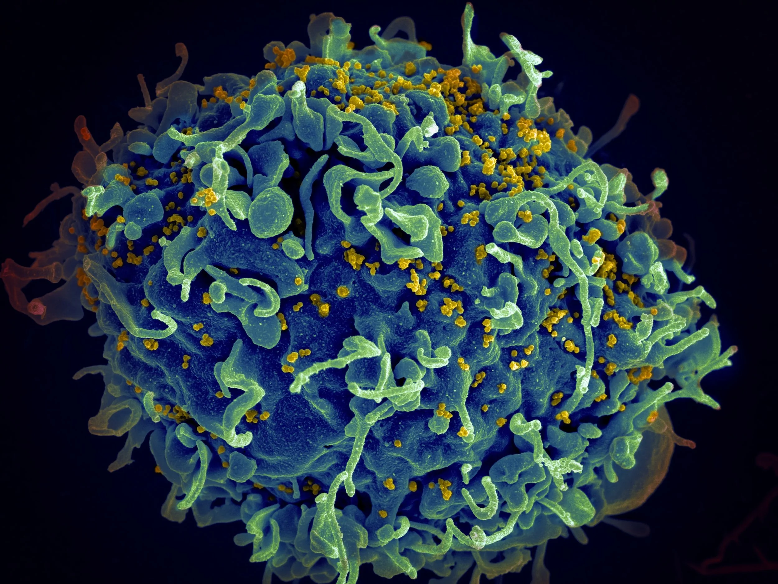 Academic Half Day: HIV 2024