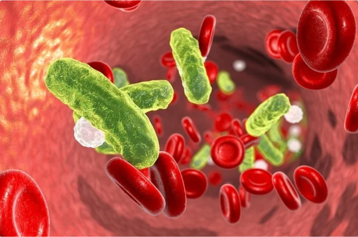 Academic Half Day: Sepsis