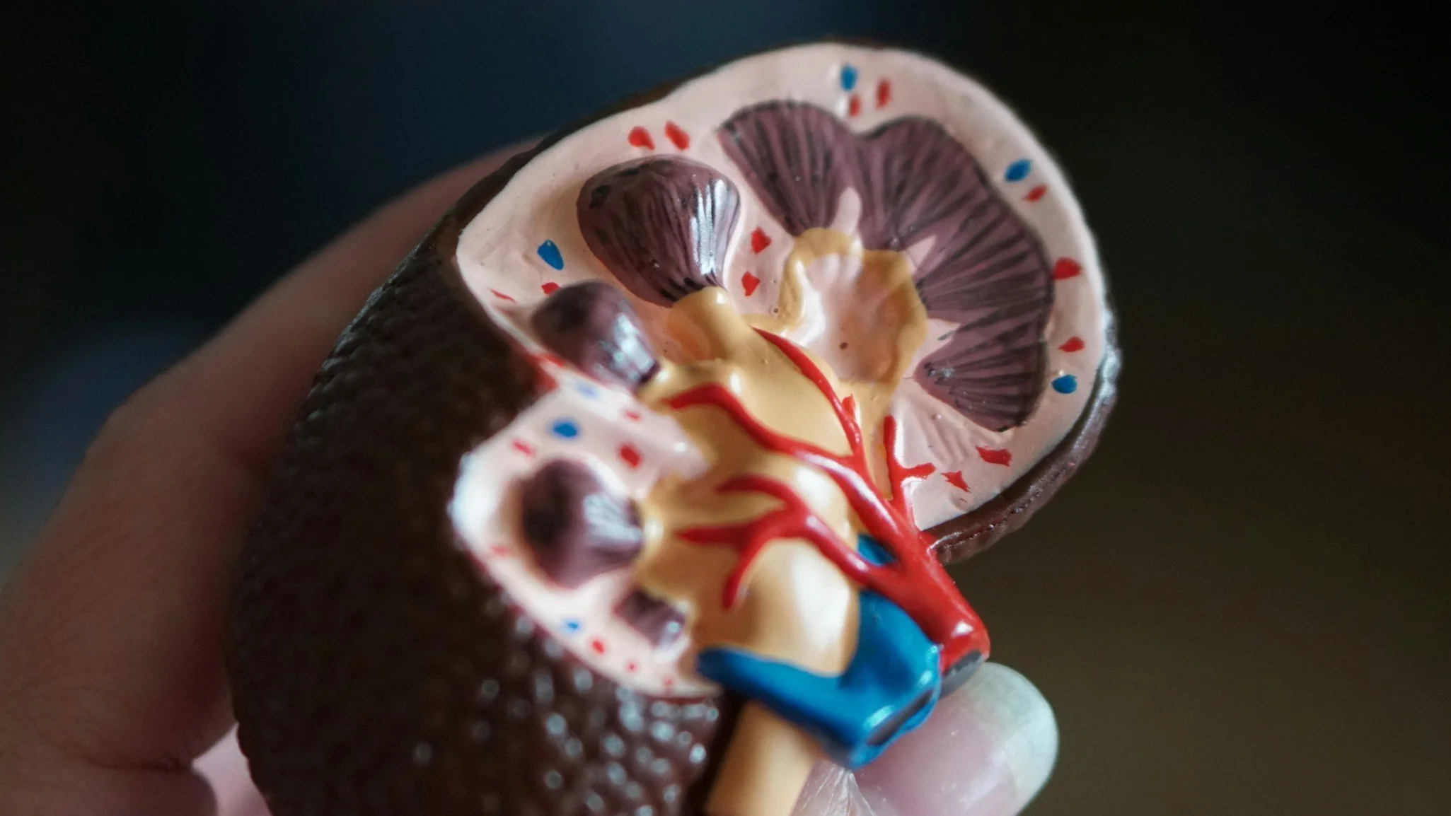 Academic Half Day: Acute Kidney Injury