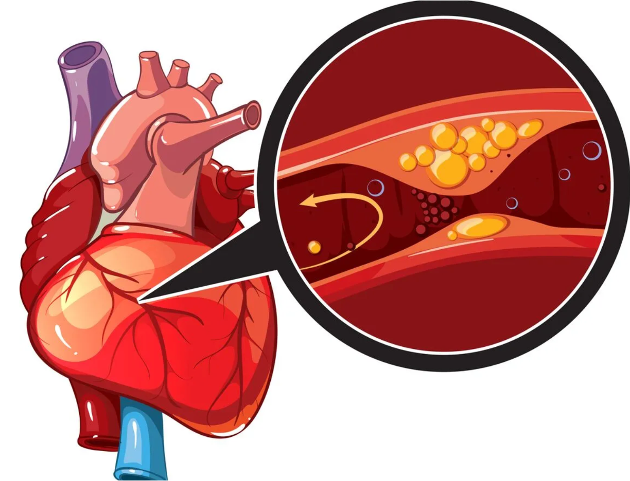Academic Half Day: Acute Coronary Syndrome (ACS)