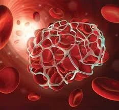 Academic Half Day: Coagulation